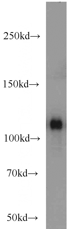 human blood tissue were subjected to SDS PAGE followed by western blot with Catalog No:108718(C3 antibody) at dilution of 1:1000