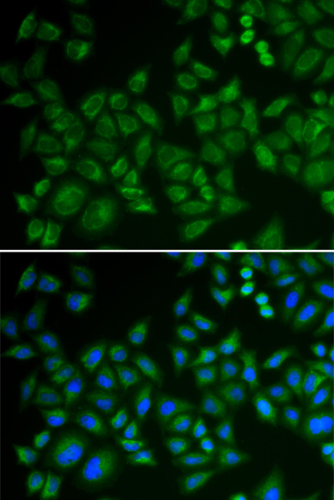 Immunofluorescence - SMPD1 / ASM Polyclonal Antibody 