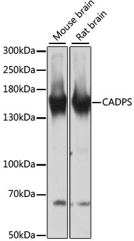 Western blot - CADPS Polyclonal Antibody 