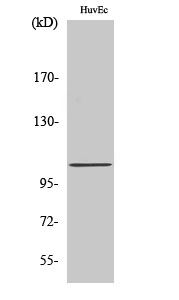 Fig1:; Western Blot analysis of various cells using CCP2 Polyclonal Antibody diluted at 1: 2000