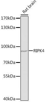 Western blot - RIPK4 Polyclonal Antibody 