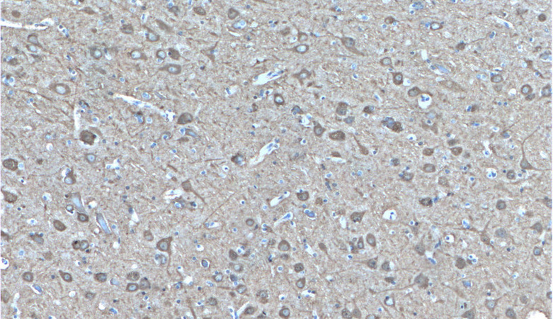 Immunohistochemistry of paraffin-embedded human brain tissue slide using Catalog No:113287(ENO2 Antibody) at dilution of 1:200 (under 10x lens)