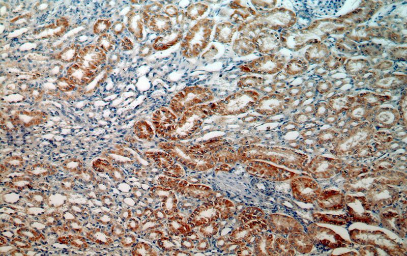 Immunohistochemical of paraffin-embedded human kidney using Catalog No:112689(MLYCD antibody) at dilution of 1:50 (under 10x lens)