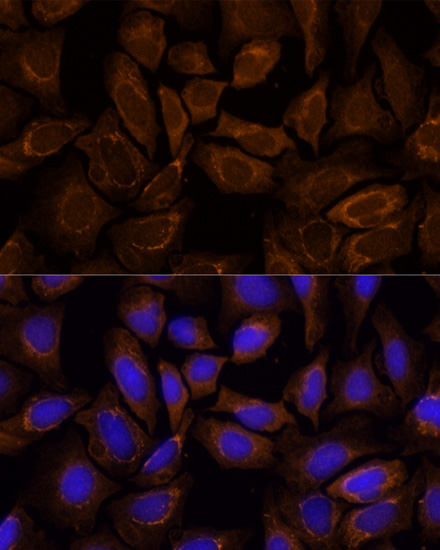 Immunofluorescence - RIPK1 Polyclonal Antibody 