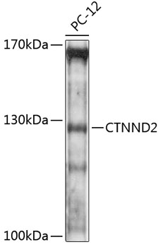 Western blot - CTNND2 Polyclonal Antibody 