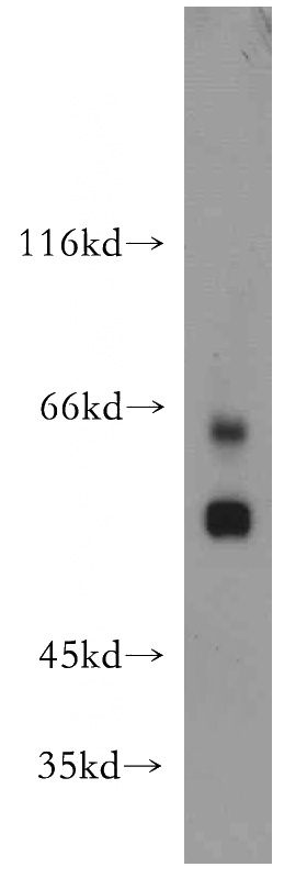 L02 cells were subjected to SDS PAGE followed by western blot with Catalog No:115612(SSTR1 antibody) at dilution of 1:600