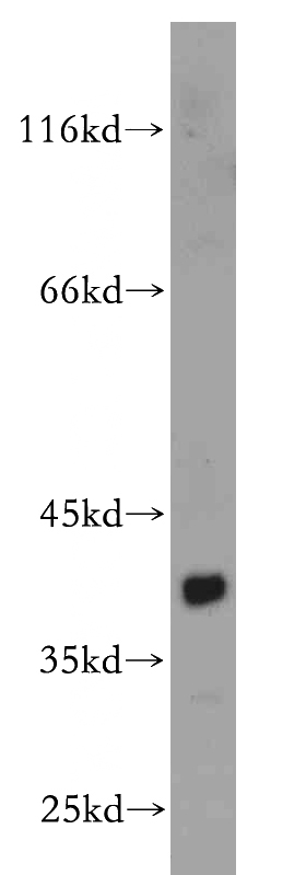 mouse kidney tissue were subjected to SDS PAGE followed by western blot with Catalog No:109118(CDCA8 antibody) at dilution of 1:300