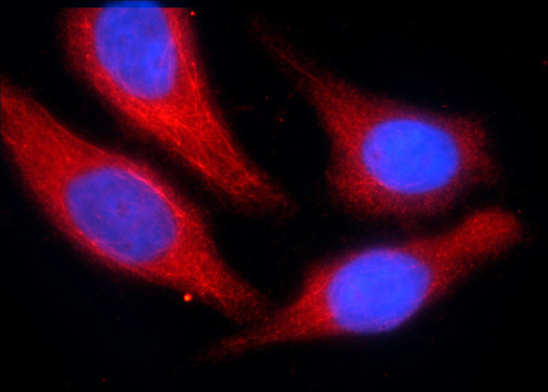 Immunofluorescent analysis of HepG2 cells using Catalog No:108726(C3orf43 Antibody) at dilution of 1:25 and Rhodamine-Goat anti-Rabbit IgG