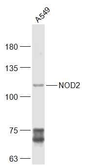 Fig2: Sample:; A549(Human) Cell Lysate at 30 ug; MCF-7(Human) Cell Lysate at 30 ug; Primary: Anti-NOD2 at 1/300 dilution; Secondary: IRDye800CW Goat Anti-Rabbit IgG at 1/20000 dilution; Predicted band size: 114 kD; Observed band size: 114 kD