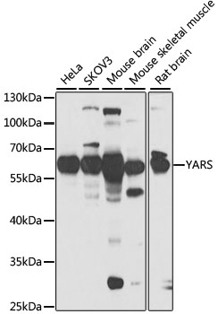 Western blot - YARS Polyclonal Antibody 
