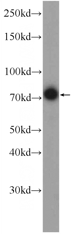 HepG2 cells were subjected to SDS PAGE followed by western blot with Catalog No:110720(FREM1 Antibody) at dilution of 1:300