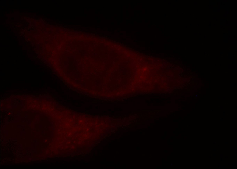 Immunofluorescent analysis of HepG2 cells, using VPS8 antibody Catalog No:116797 at 1:25 dilution and Rhodamine-labeled goat anti-rabbit IgG (red).