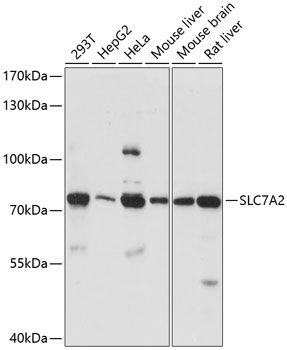 Western blot - SLC7A2 Polyclonal Antibody 