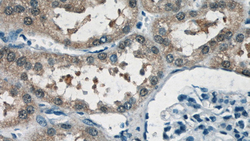 Immunohistochemistry of paraffin-embedded human kidney tissue slide using Catalog No:113357(NUDT16 Antibody) at dilution of 1:50 (under 40x lens)
