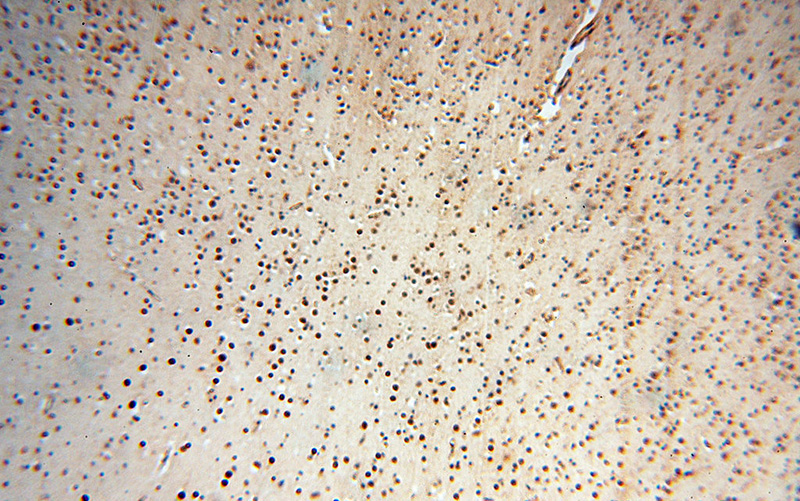 Immunohistochemical of paraffin-embedded human brain using Catalog No:112078(KLF13 antibody) at dilution of 1:50 (under 10x lens)