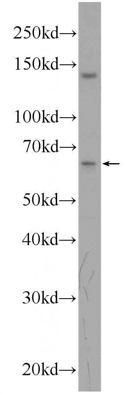 PC-3 cells were subjected to SDS PAGE followed by western blot with Catalog No:111156(GRAMD4 Antibody) at dilution of 1:300
