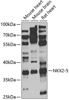 Western blot - NKX2-5 Polyclonal Antibody 