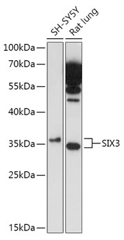 Western blot - SIX3 Polyclonal Antibody 