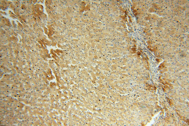 Immunohistochemical of paraffin-embedded human liver using Catalog No:111339(HP antibody) at dilution of 1:50 (under 10x lens)