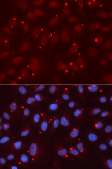 Immunofluorescence - XRCC3 Polyclonal Antibody 