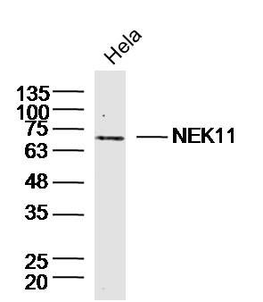 Fig1: Sample: Hela (Human)Cell Lysate at 40 ug; Primary: Anti- NEK11 at 1/300 dilution; Secondary: IRDye800CW Goat Anti-RabbitIgG at 1/20000 dilution; Predicted band size: 54'74kD; Observed band size: 70kD