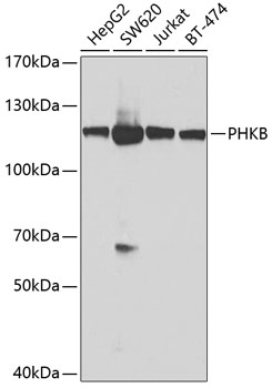 Western blot - PHKB Polyclonal Antibody 