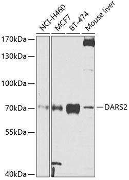 Western blot - DARS2 Polyclonal Antibody 