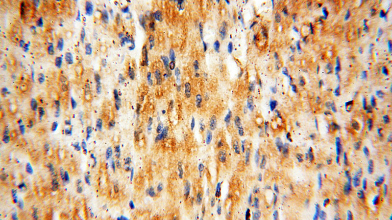Immunohistochemical of paraffin-embedded human heart using Catalog No:109980(DIXDC1 antibody) at dilution of 1:100 (under 40x lens)