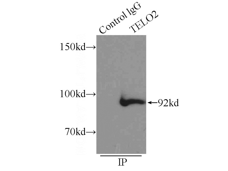 IP Result of anti-TELO2 (IP:Catalog No:115941, 3ug; Detection:Catalog No:115941 1:1000) with Y79 cells lysate 2000ug.