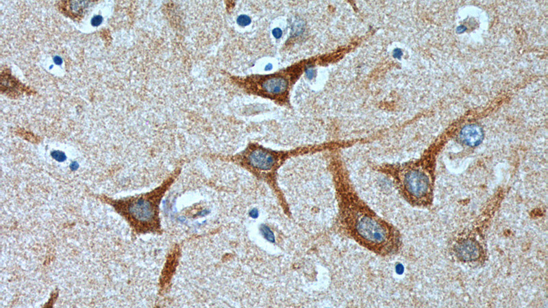 Immunohistochemistry of paraffin-embedded human brain tissue slide using Catalog No:113208(NPBWR2 Antibody) at dilution of 1:100 (under 40x lens).