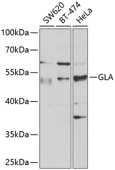 Western blot - GLA Polyclonal Antibody 