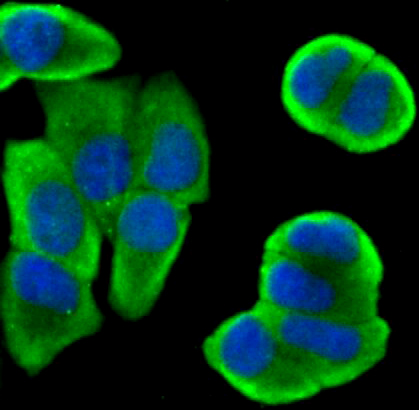 Immunocytochemistry staining of MCF-7 cells (green) fixed with paraformaldehyde, permeabilised with 0.25% Triton X100/PBS, and using Bcl-2 Antibody. The nuclear counter stain is DAPI (blue).