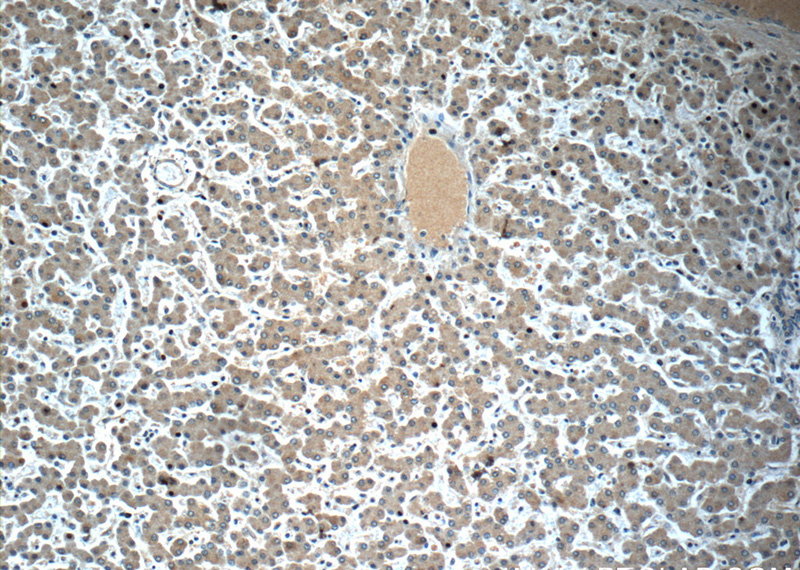 Immunohistochemistry of paraffin-embedded human liver slide using Catalog No:112412(LYRM7 Antibody) at dilution of 1:50 (under 10x lens)