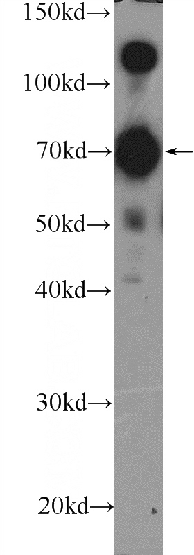 rat brain tissue were subjected to SDS PAGE followed by western blot with Catalog No:112049(KIF5C Antibody) at dilution of 1:1500