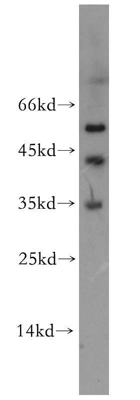 NIH/3T3 cells were subjected to SDS PAGE followed by western blot with Catalog No:115015(SCPX antibody) at dilution of 1:2000