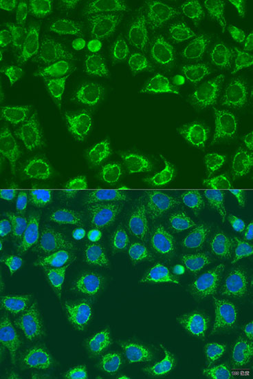 Immunofluorescence - ALG2 Polyclonal Antibody 