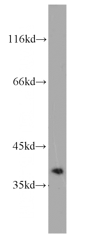 A375 cells were subjected to SDS PAGE followed by western blot with Catalog No:109668(CCNH antibody) at dilution of 1:1000