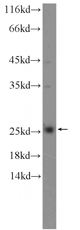 NIH/3T3 cells were subjected to SDS PAGE followed by western blot with Catalog No:112330(LRRC20 Antibody) at dilution of 1:600