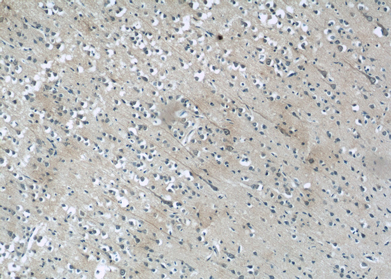 Immunohistochemistry of paraffin-embedded human brain tissue slide using Catalog No:110631(FGF13 Antibody) at dilution of 1:50 (under 10x lens)