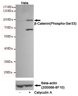 Western blot detection of u03b2-Catenin(Phospho-Ser33) in Hela cells untreated or Calyculin A-treated, using u03b2-Catenin(Phospho-Ser33) Rabbit pAb (dilution 1:1000, upper) or u03b2-Actin Mouse mAb (200068-8F10, lower).Predicted band size:92kDa.Observed band size:92kDa.
