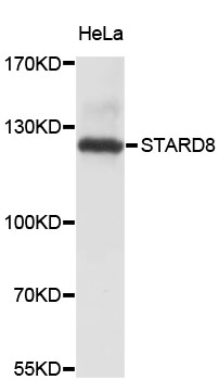 Western blot - STARD8 Polyclonal Antibody 