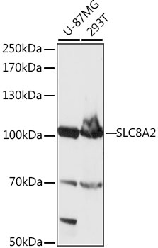 Western blot - SLC8A2 Polyclonal Antibody 