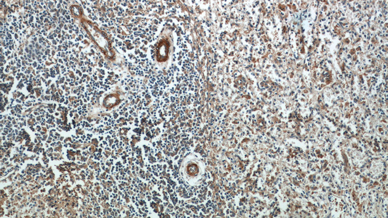 Immunohistochemical of paraffin-embedded human spleen using Catalog No:112158(LAX1 antibody) at dilution of 1:100 (under 10x lens)