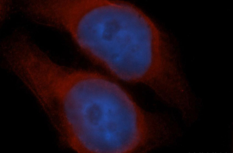 Immunofluorescent analysis of Hela cells, using UBXN6 antibody Catalog No:116666 at 1:50 dilution and Rhodamine-labeled goat anti-rabbit IgG (red). Blue pseudocolor = DAPI (fluorescent DNA dye).