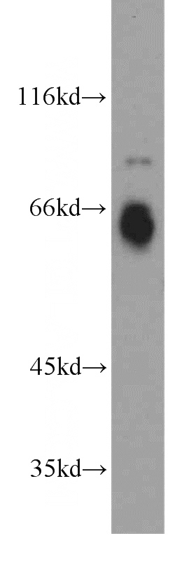human brain tissue were subjected to SDS PAGE followed by western blot with Catalog No:108617(C18orf8 antibody) at dilution of 1:1500