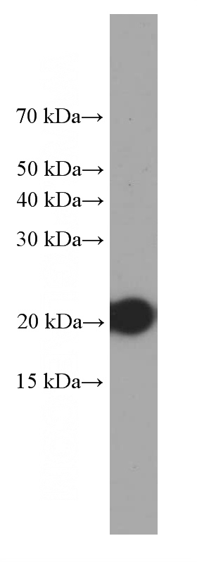 MCF-7 cells were subjected to SDS PAGE followed by western blot with Catalog No:107442(P21 Antibody) at dilution of 1:1000