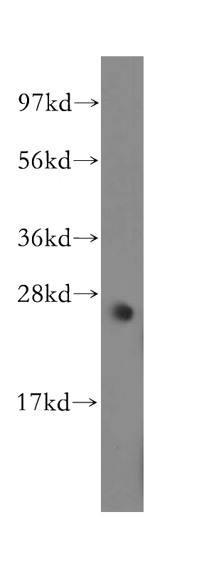 mouse skeletal muscle tissue were subjected to SDS PAGE followed by western blot with Catalog No:112926(MYF6 antibody) at dilution of 1:500