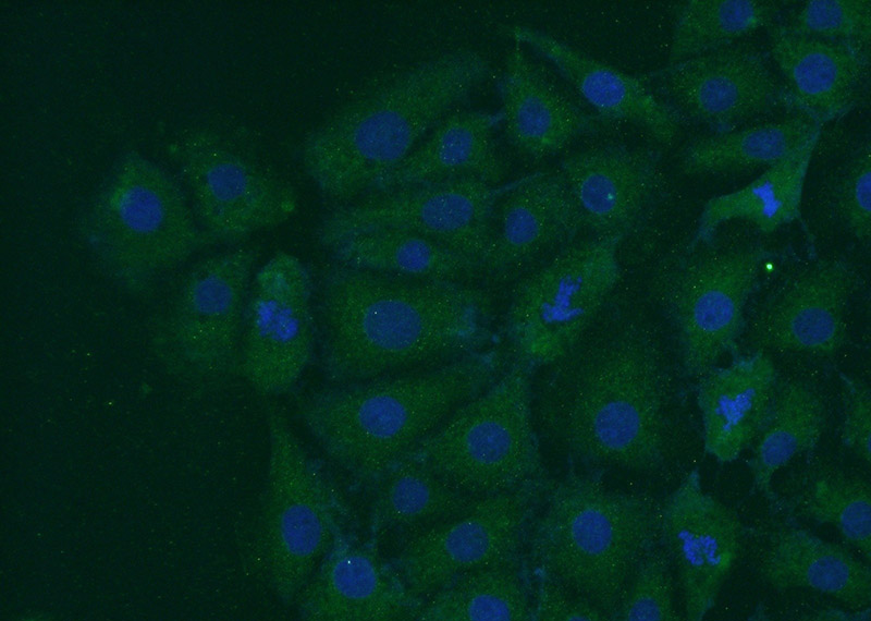 Immunofluorescent analysis of SH-SY5Y cells using Catalog No:113584(PARK7,DJ-1 Antibody) at dilution of 1:50 and Alexa Fluor 488-congugated AffiniPure Goat Anti-Rabbit IgG(H+L)