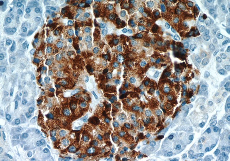 Immunohistochemical of paraffin-embedded human pancreas using Catalog No:109288(CHGA antibody) at dilution of 1:400 (under 40x lens)