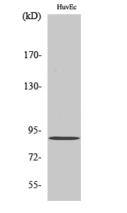 Fig1:; Western Blot analysis of various cells using iPLA2γ Polyclonal Antibody diluted at 1: 2000